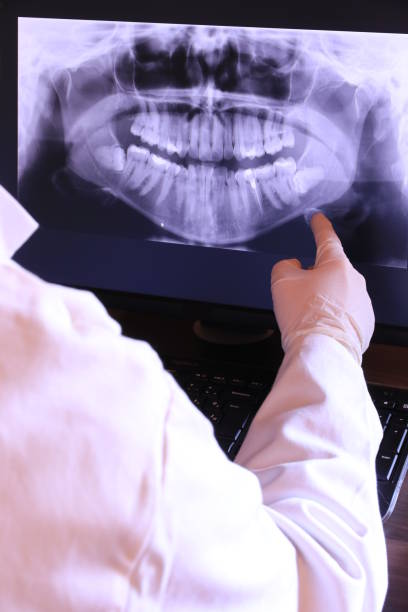 Best Chipped Tooth Repair Near Me  in Bucyrus, OH